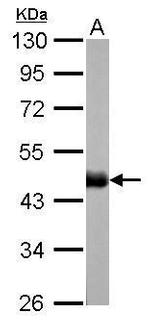 Citrate Synthase Antibody in Western Blot (WB)