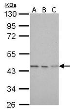 Citrate Synthase Antibody in Western Blot (WB)