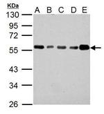 IP6K1 Antibody in Western Blot (WB)