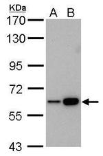 CBS Antibody in Western Blot (WB)