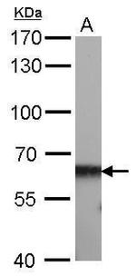 CBS Antibody in Western Blot (WB)