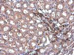 TAGLN Antibody in Immunohistochemistry (Paraffin) (IHC (P))