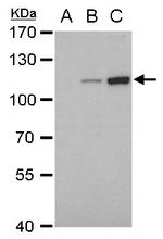 Dengue Virus Type 2 NS5 Antibody in Western Blot (WB)