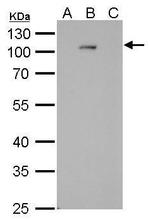 Dengue Virus Type 2 NS5 Antibody in Western Blot (WB)