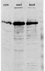 hnRNP F Antibody in Western Blot (WB)