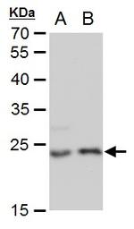 LIN7A Antibody in Western Blot (WB)
