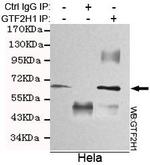 GTF2H1 Antibody in Immunoprecipitation (IP)