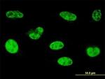 HOXA5 Antibody in Immunocytochemistry (ICC/IF)