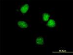 HOXA5 Antibody in Immunocytochemistry (ICC/IF)