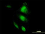 HSPA2 Antibody in Immunocytochemistry (ICC/IF)