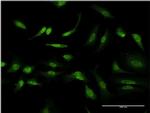 ID1 Antibody in Immunocytochemistry (ICC/IF)