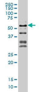 NFIC Antibody in Western Blot (WB)