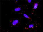 MEK5 Antibody in Proximity Ligation Assay (PLA) (PLA)