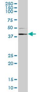 RING1 Antibody in Western Blot (WB)