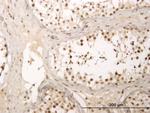 ZNF213 Antibody in Immunohistochemistry (PFA fixed) (IHC (PFA))