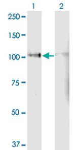 LPIN1 Antibody in Western Blot (WB)