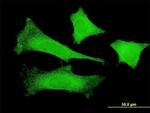 FBXO4 Antibody in Immunocytochemistry (ICC/IF)