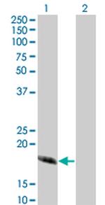 CABP4 Antibody in Western Blot (WB)