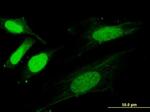 SNX20 Antibody in Immunocytochemistry (ICC/IF)