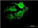 UNC5CL Antibody in Immunocytochemistry (ICC/IF)