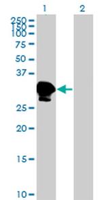 ZNF396 Antibody in Western Blot (WB)