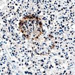 Angiopoietin 1 Antibody in Immunohistochemistry (Paraffin) (IHC (P))