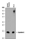 Cystatin C Antibody in Western Blot (WB)