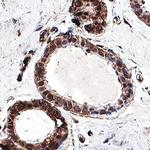 BRCA2 Antibody in Immunohistochemistry (Paraffin) (IHC (P))