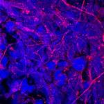 CNDP1 Antibody in Immunocytochemistry (ICC/IF)