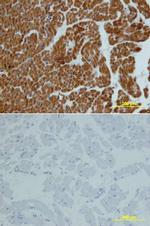 CNDP1 Antibody in Immunohistochemistry (Paraffin) (IHC (P))