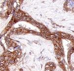 COL23A1 Antibody in Immunohistochemistry (Paraffin) (IHC (P))