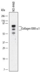 COL23A1 Antibody in Western Blot (WB)