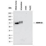 ADAM22 Antibody in Western Blot (WB)