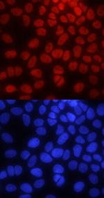 PYGO2 Antibody in Immunocytochemistry (ICC/IF)