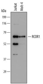 RCOR1 Antibody in Western Blot (WB)