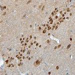 NMNAT1 Antibody in Immunohistochemistry (Frozen) (IHC (F))