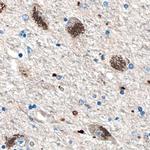 HEXA Antibody in Immunohistochemistry (Paraffin) (IHC (P))