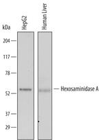HEXA Antibody in Western Blot (WB)
