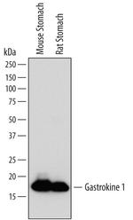 GKN1 Antibody in Western Blot (WB)