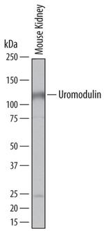 Uromodulin Antibody in Western Blot (WB)