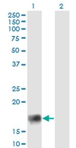 XAGE2 Antibody in Western Blot (WB)