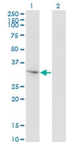 THG1L Antibody in Western Blot (WB)