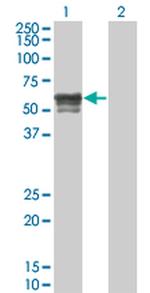 IRX6 Antibody in Western Blot (WB)