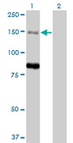MTMR3 Antibody in Western Blot (WB)