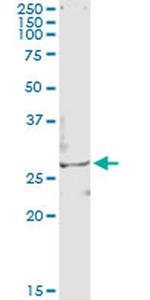 TSSK3 Antibody in Immunoprecipitation (IP)