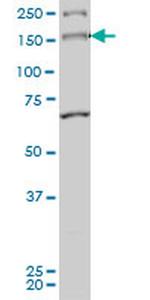 MYO3A Antibody in Western Blot (WB)