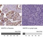 WWTR1 Antibody in Immunohistochemistry (IHC)