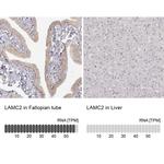 Laminin gamma-2 Antibody in Immunohistochemistry (IHC)