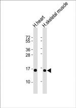 TUSC2 Antibody in Western Blot (WB)