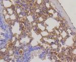 RPS3 Antibody in Immunohistochemistry (Paraffin) (IHC (P))